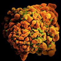 Scanning electron micrograph of an HIV-infected H9 T cell.